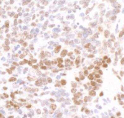 Immunohistochemistry-Paraffin: RNA Polymerase II/POLR2A [p Ser2] Antibody [NB100-1805]